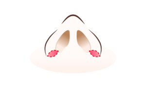 内側法