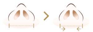 外側法