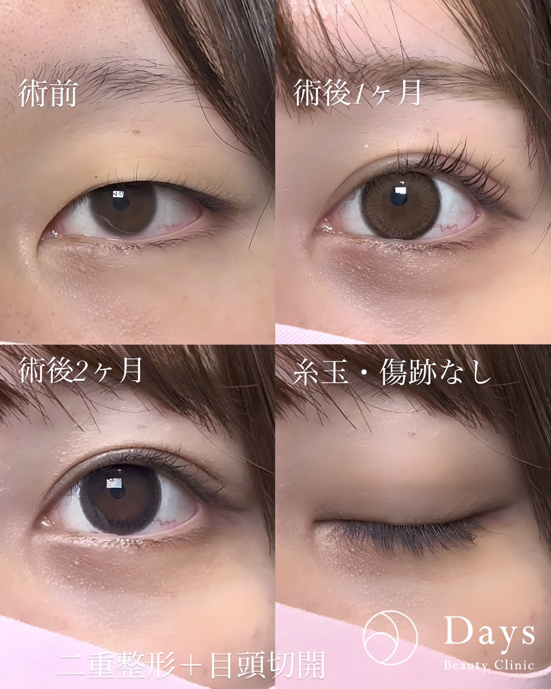 B4AC5450-A35A-4C5E-9245-2CCF86077CC4