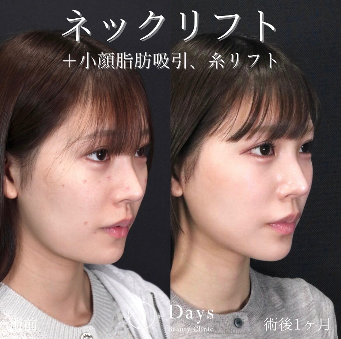 image_20250428_11.14.15