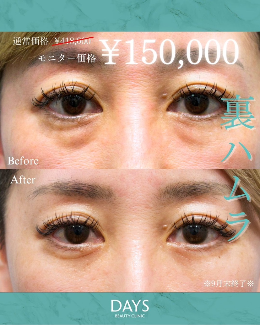 裏ハムラ2509-2