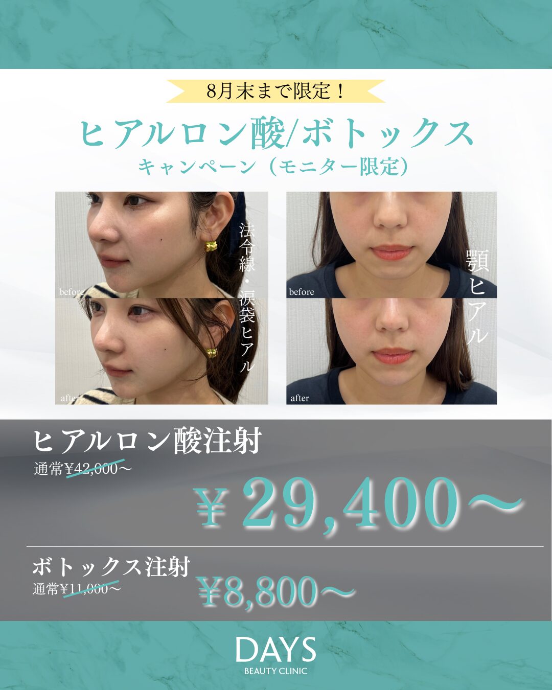 ヒアルロン酸2508