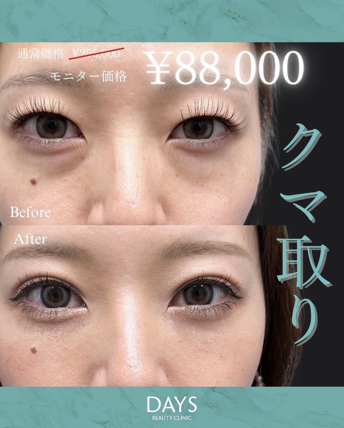 クマ取り2508