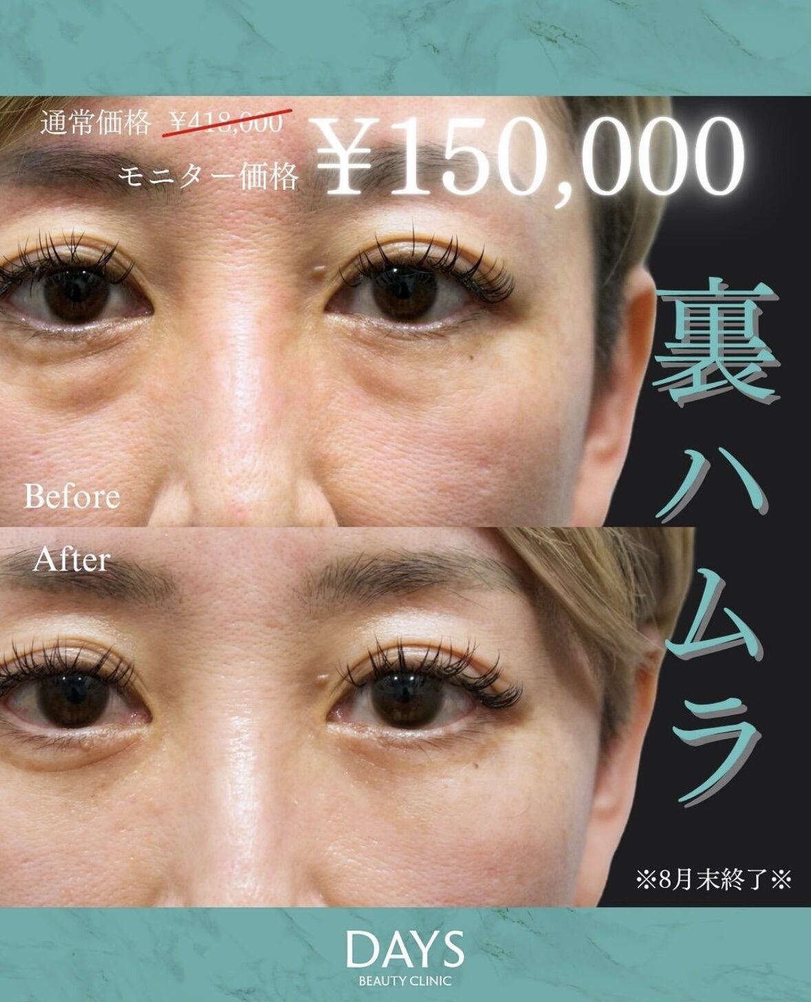裏ハムラ2508