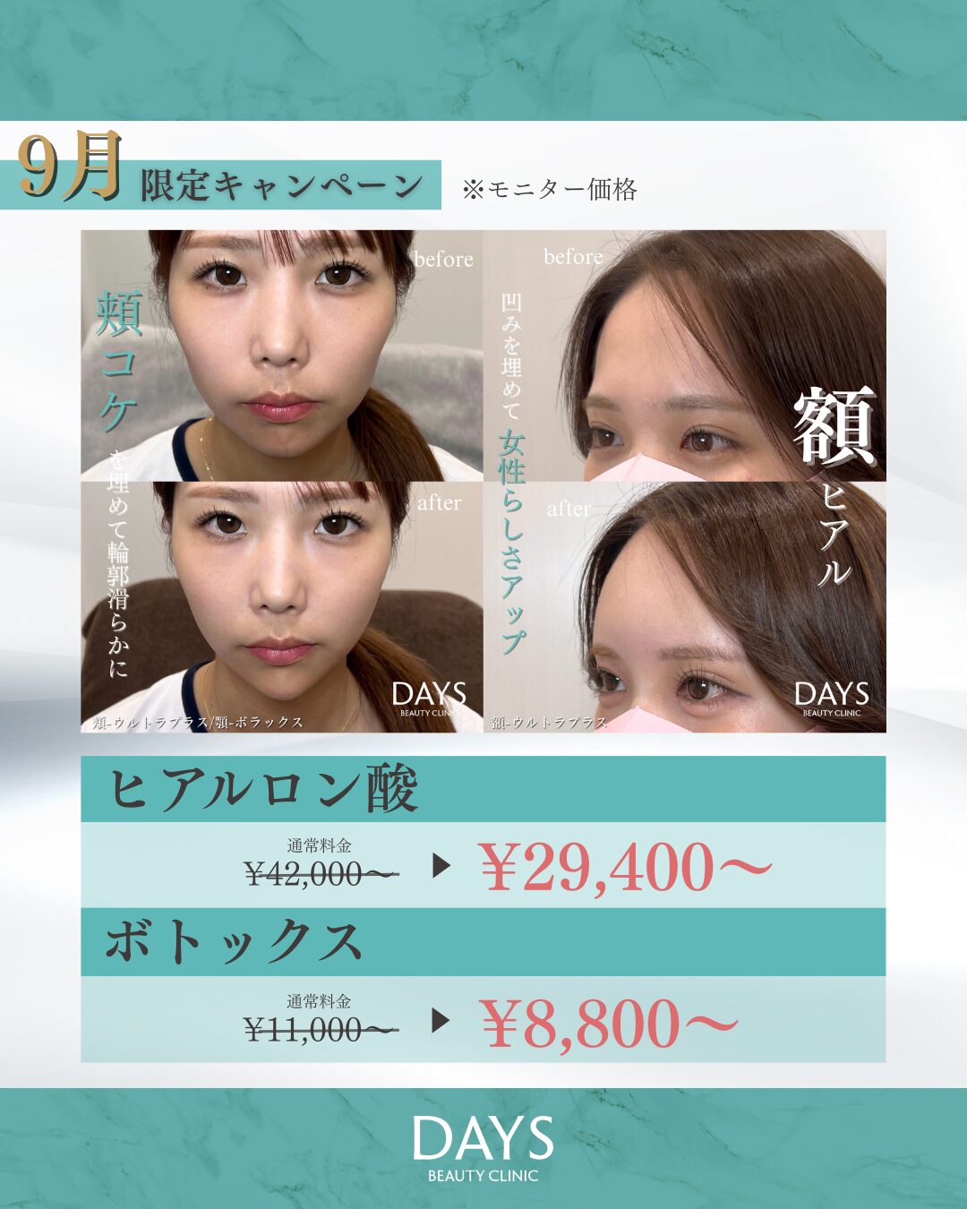 ヒアルロン酸2509