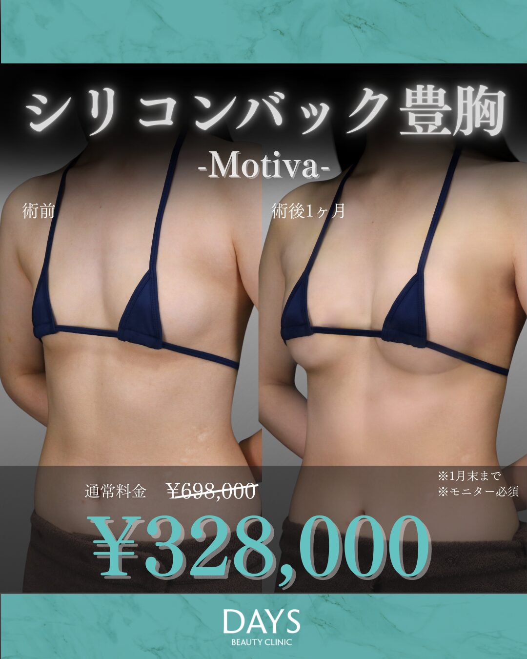 シリコンバック　2601