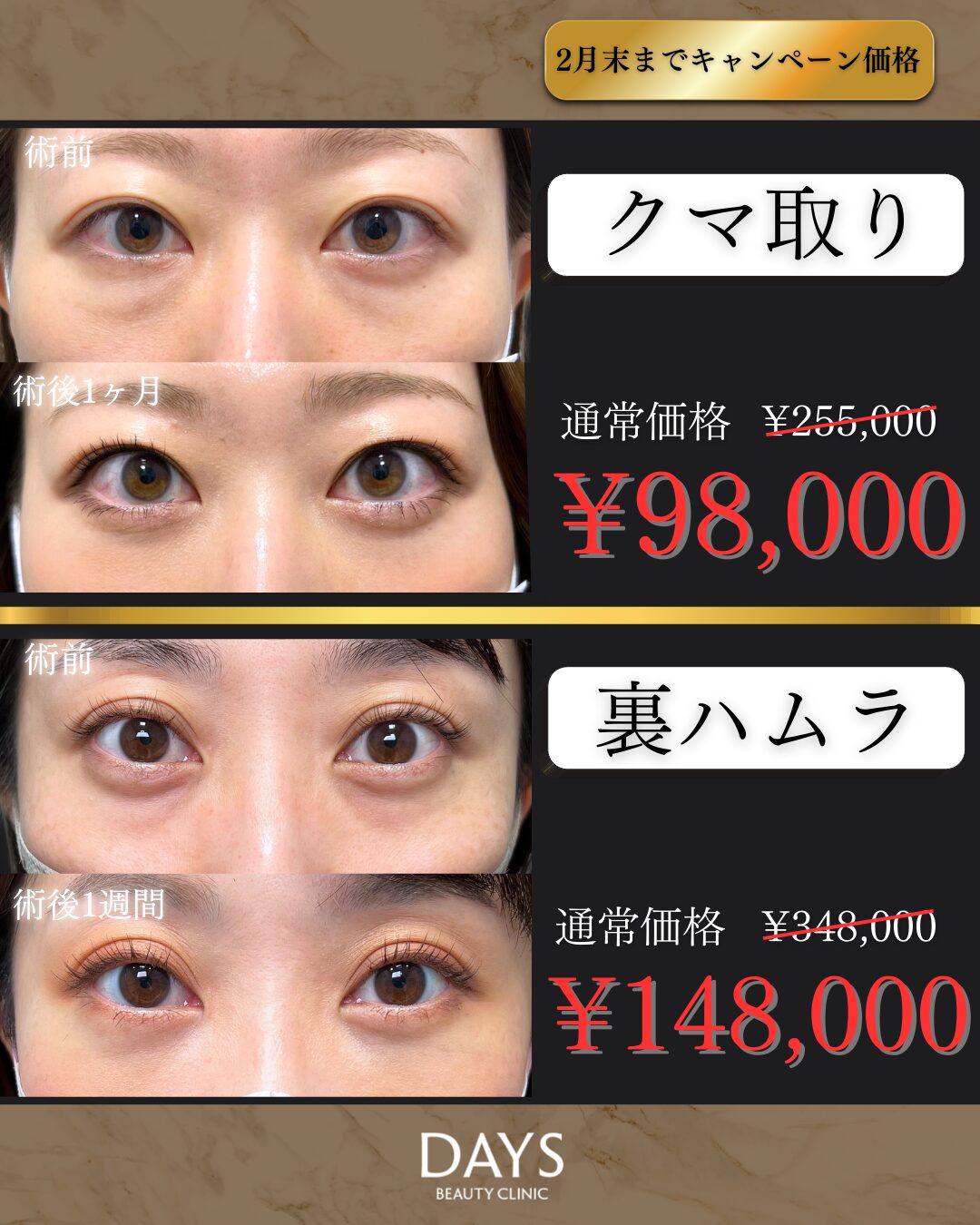 クマ取り・裏ハムラ2602