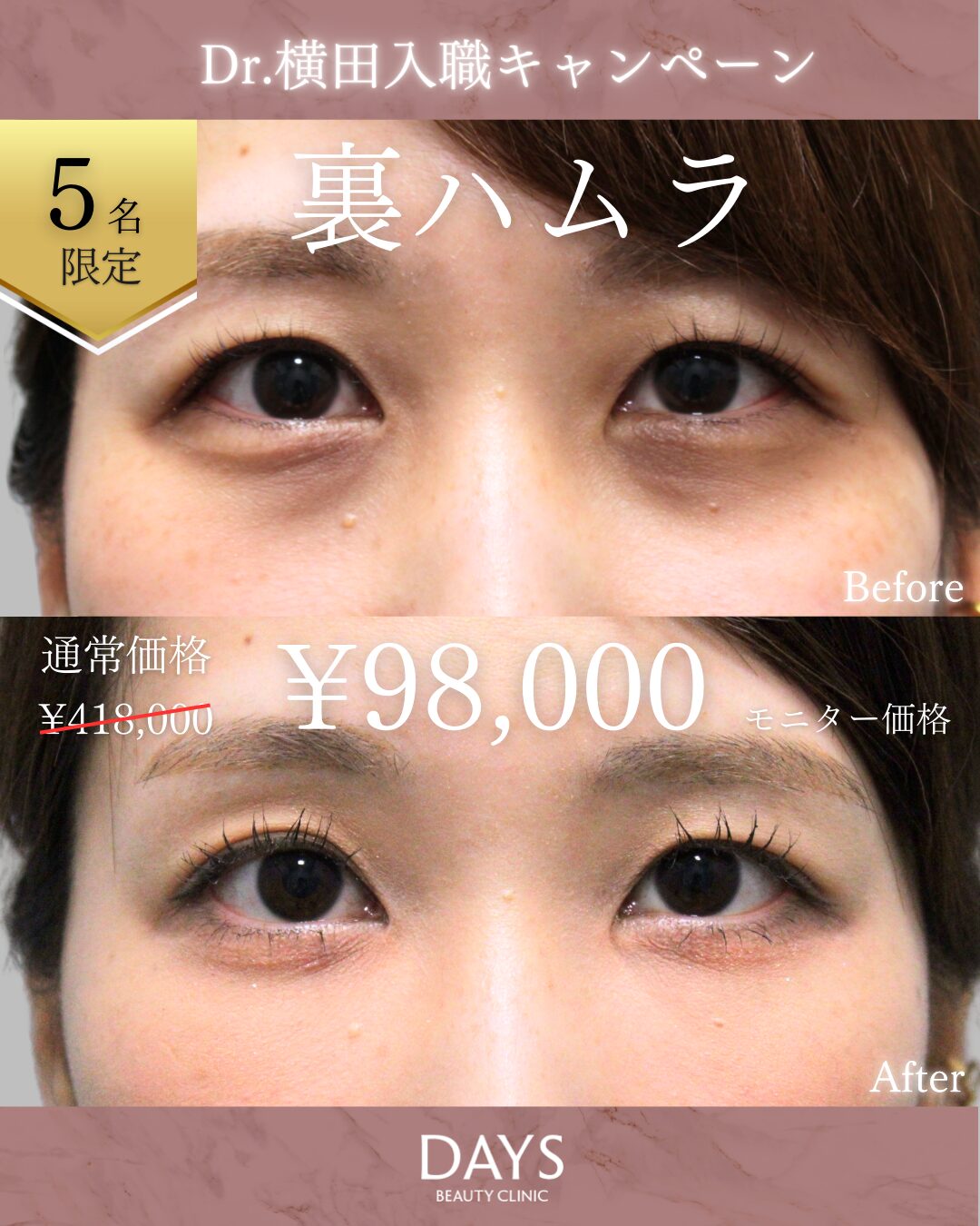 裏ハムラ2509