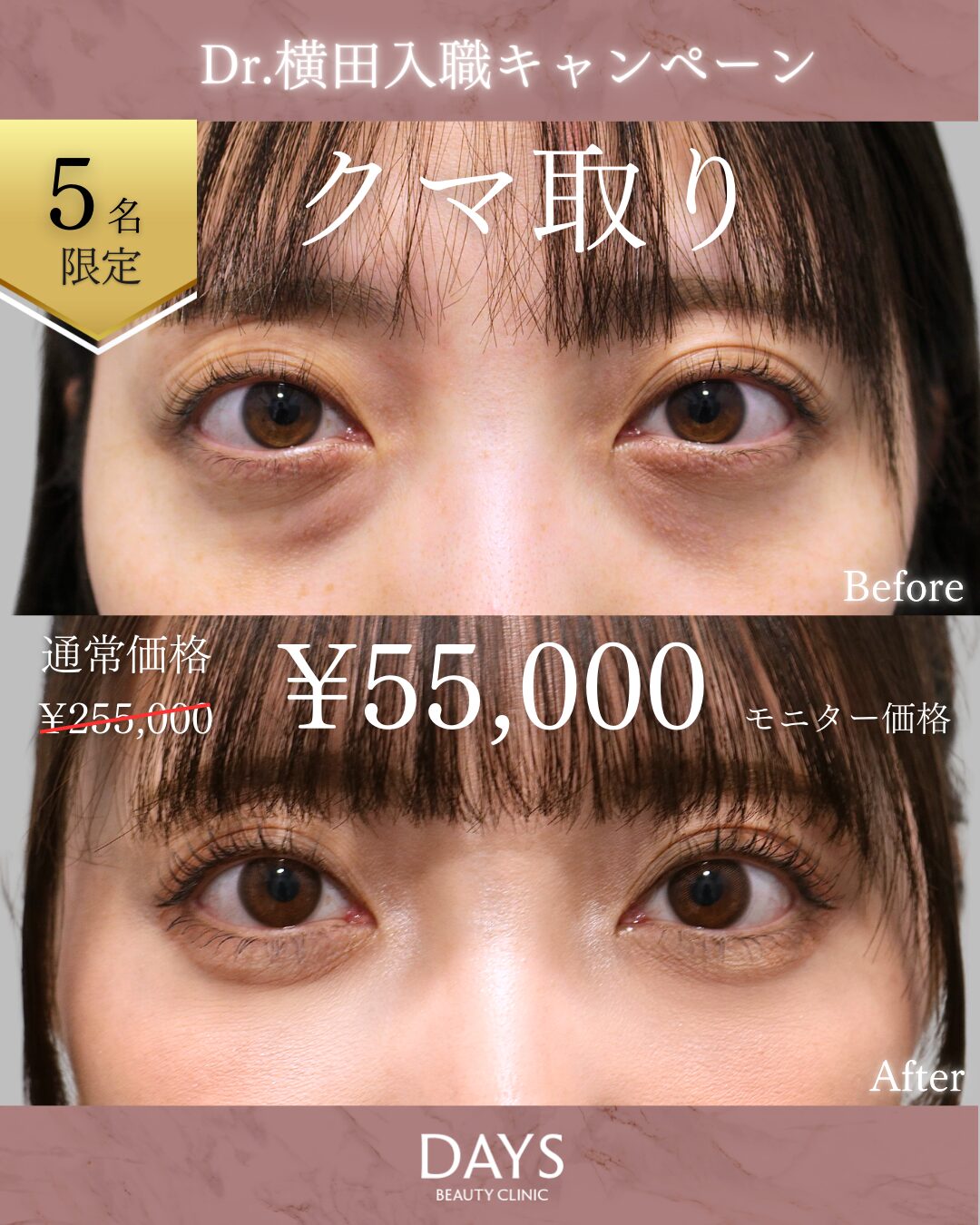 クマ取り2509
