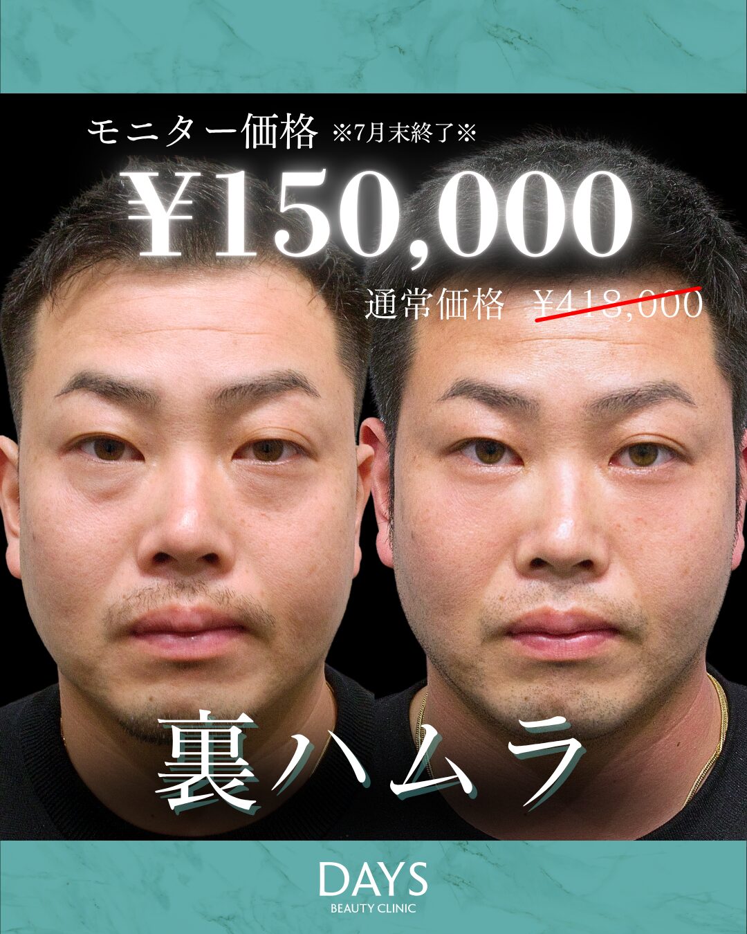 裏ハムラ01