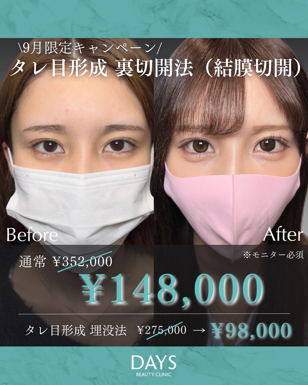 タレ目成形2509