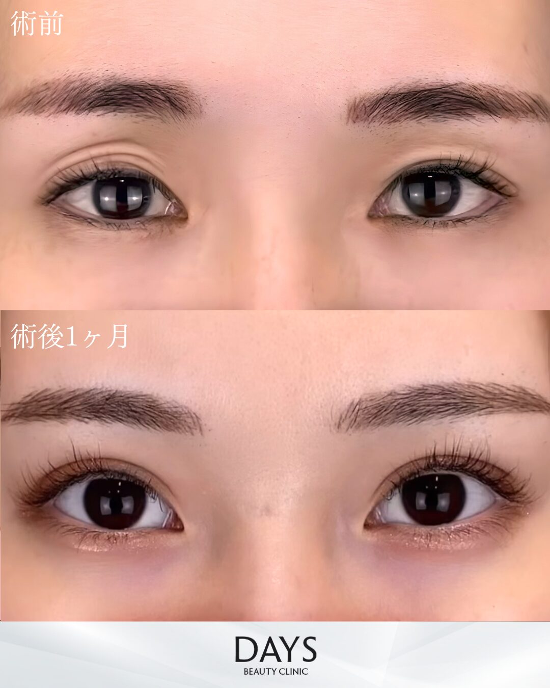 黒田二重.png