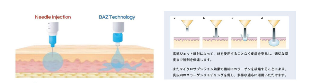 キュアジェットの仕組み