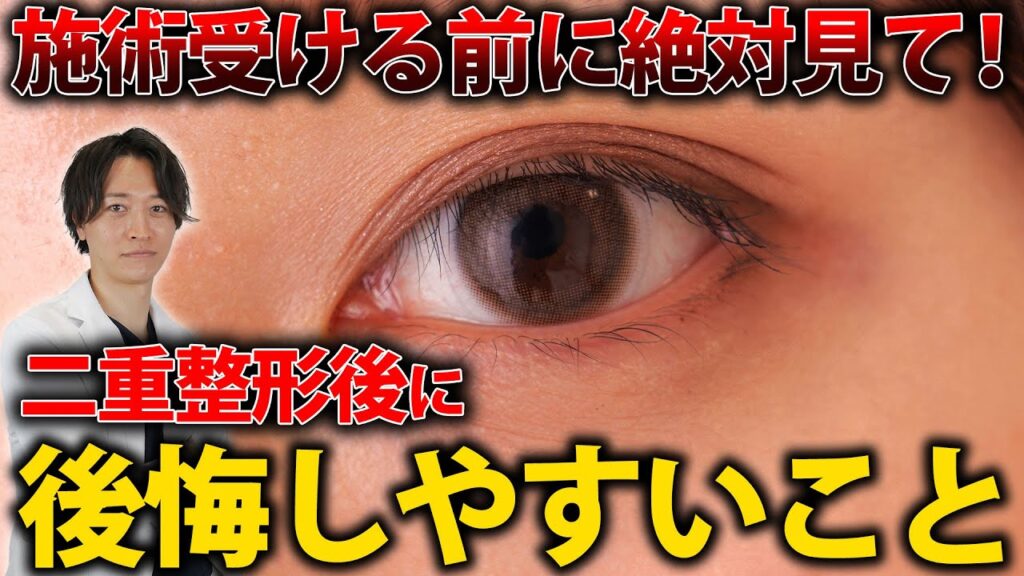 【絶対見て!】二重整形後に後悔しやすいこと。
