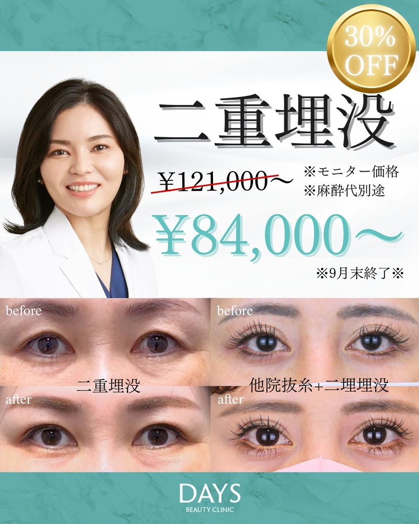 二重埋没2509