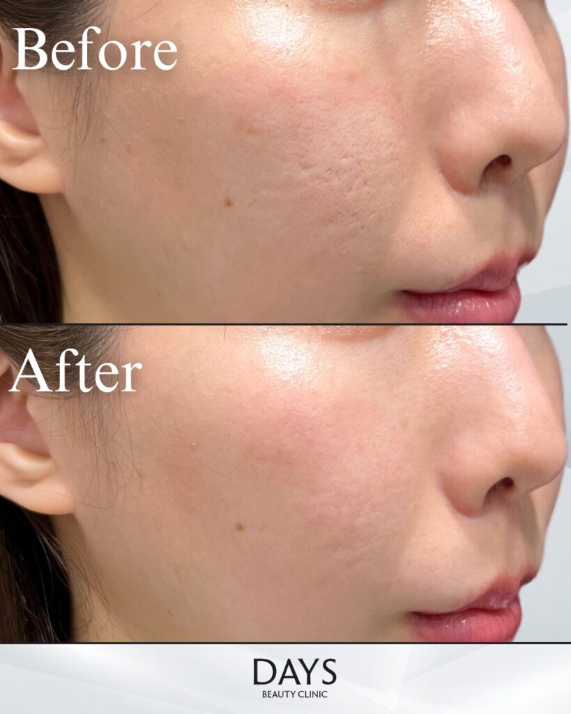 ジュベルック-の症例　20代女性