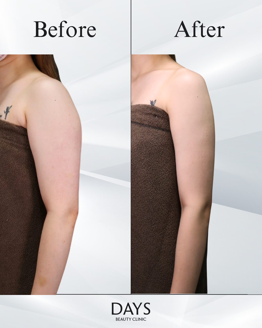 鍋田-森田症例.png-11