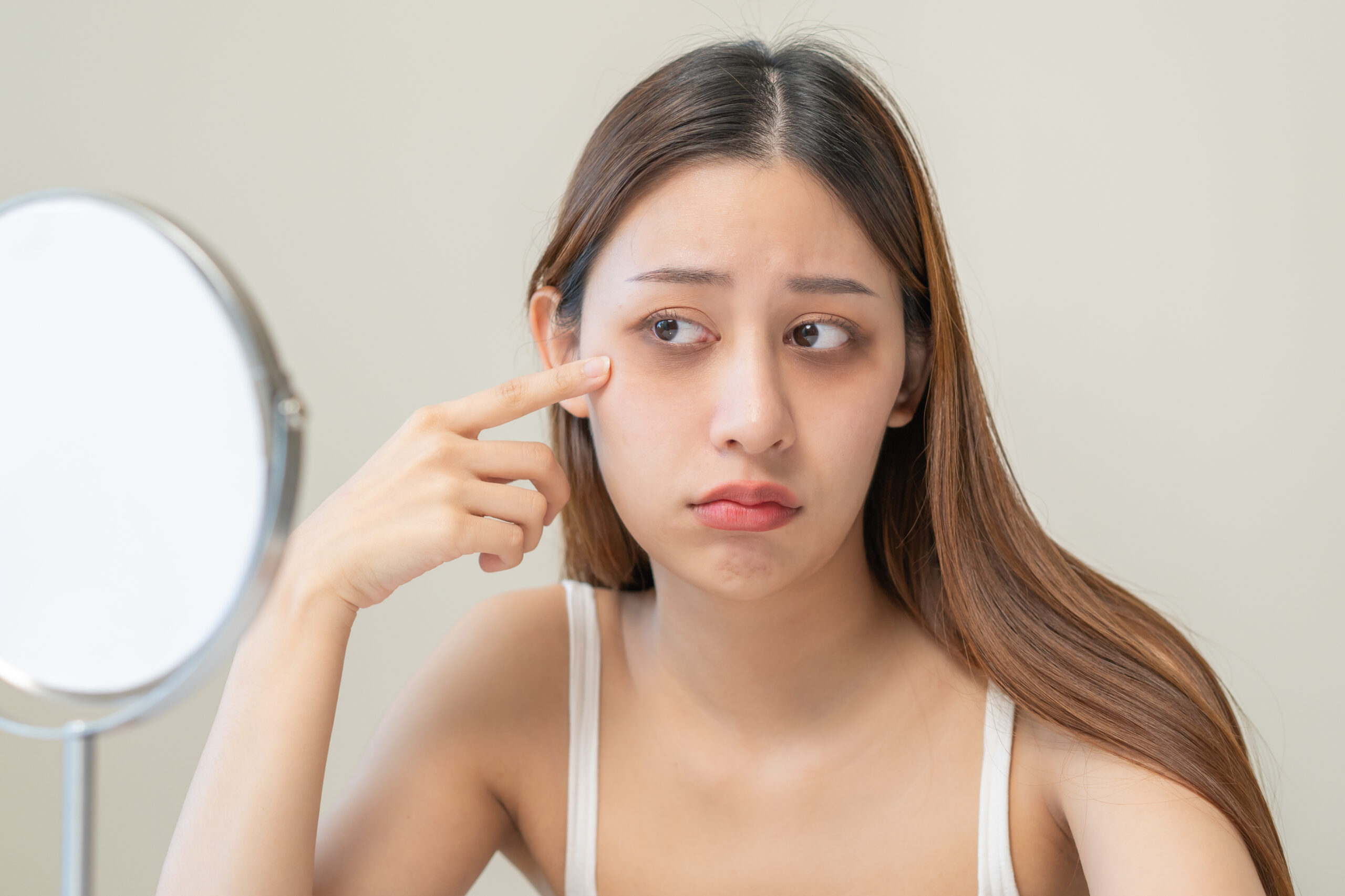 若い人の黒クマはなぜ起きる？｜原因とおすすめの治療法まとめ
