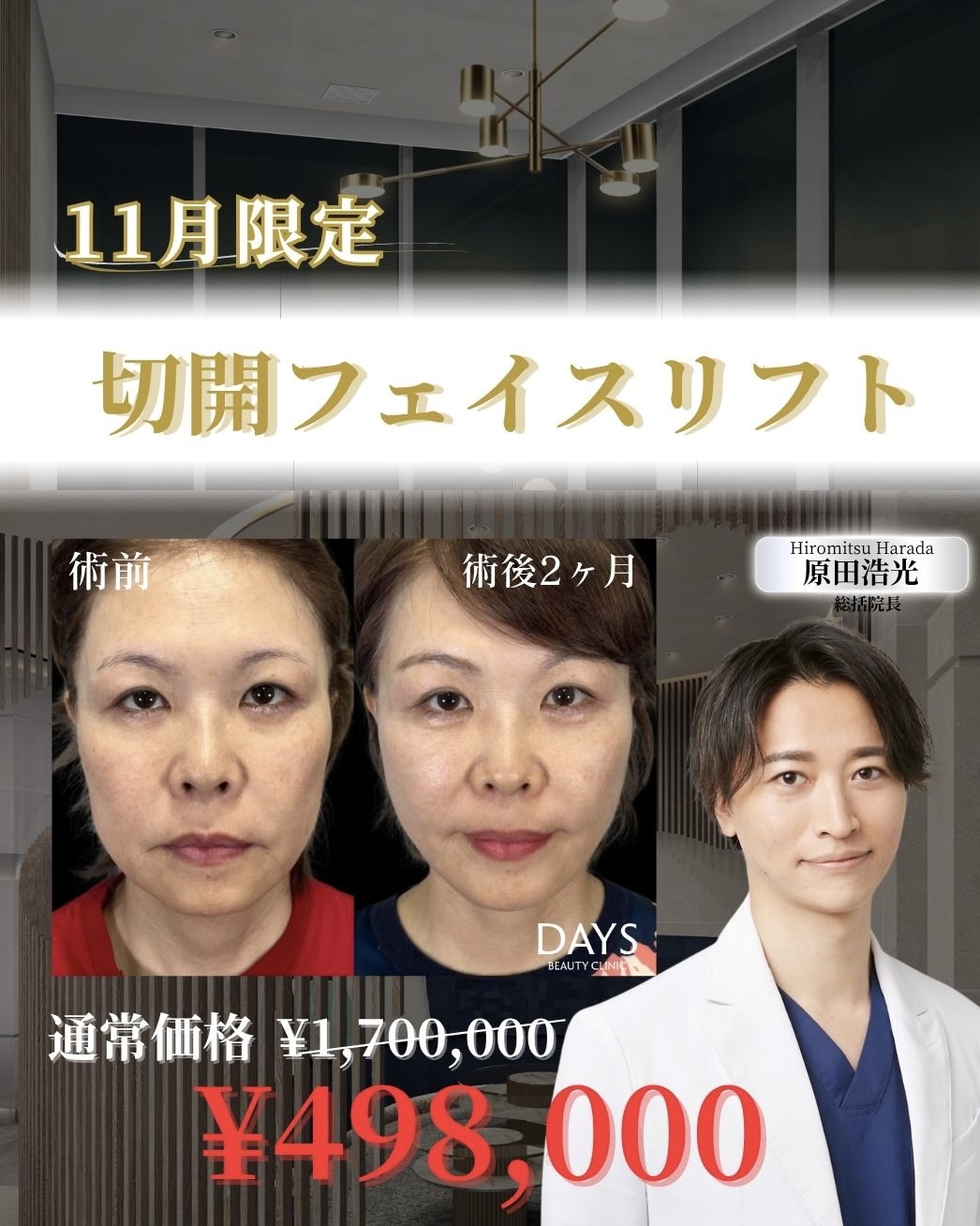 フェイスリフト 2511