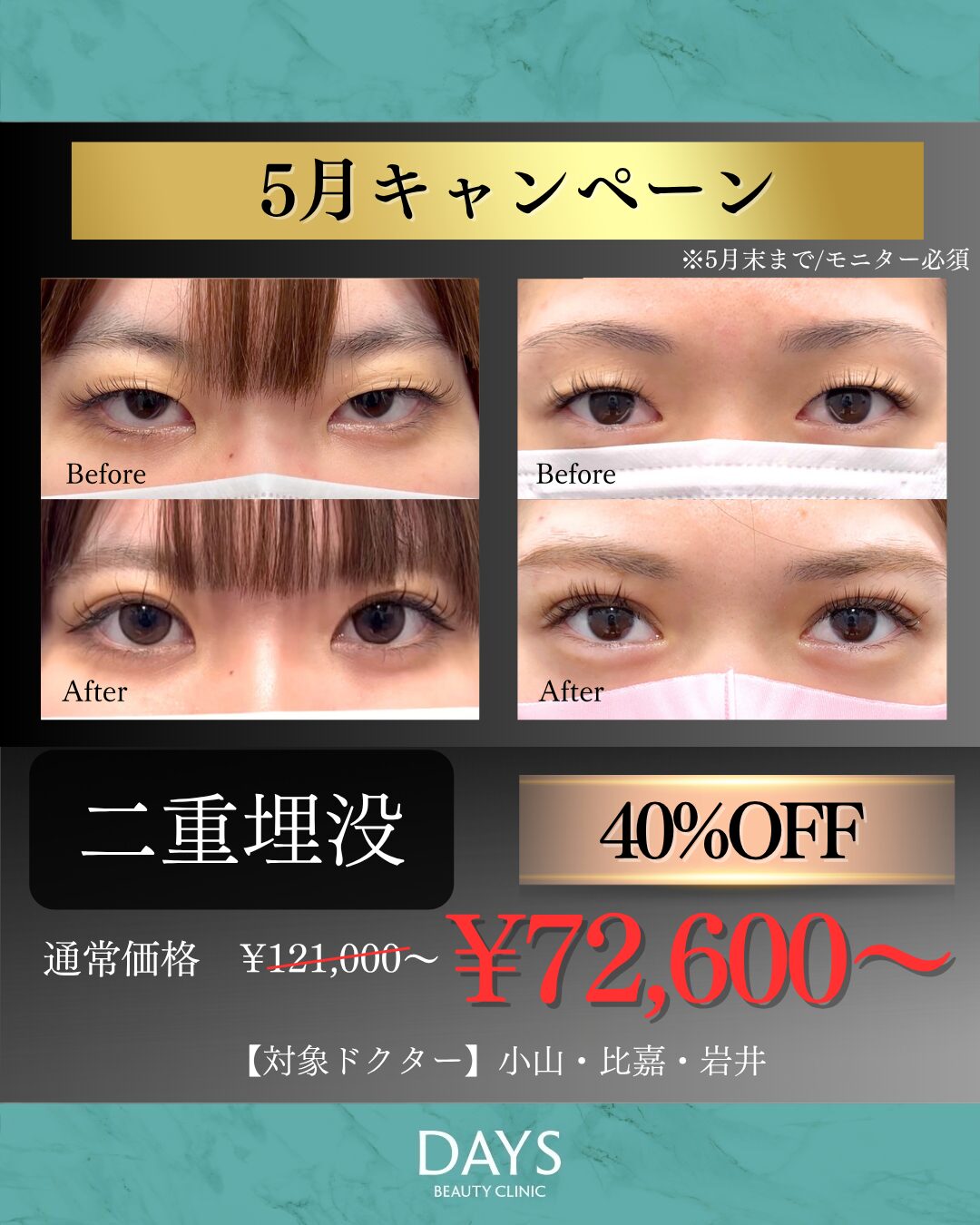二重40％オフ　岩井・小山・比嘉　2605