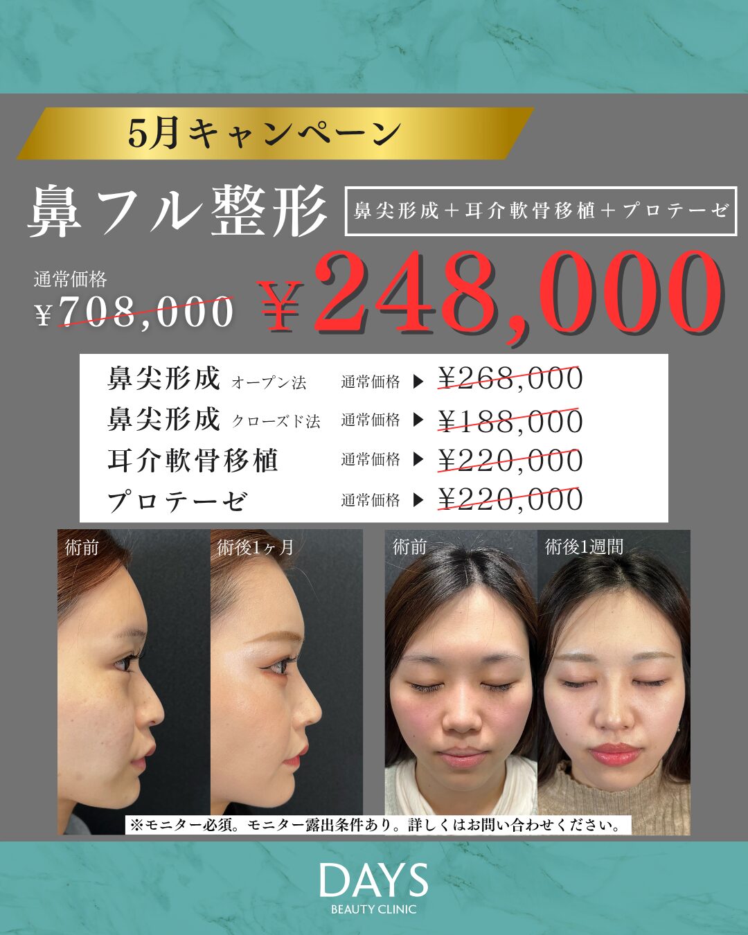 鼻フル 今井　2605
