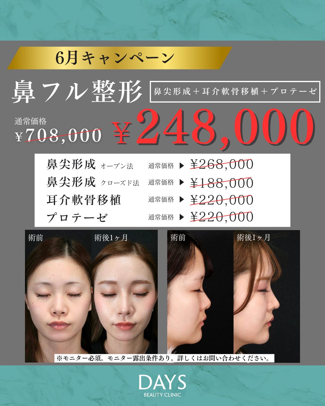 鼻フル 今井　2606