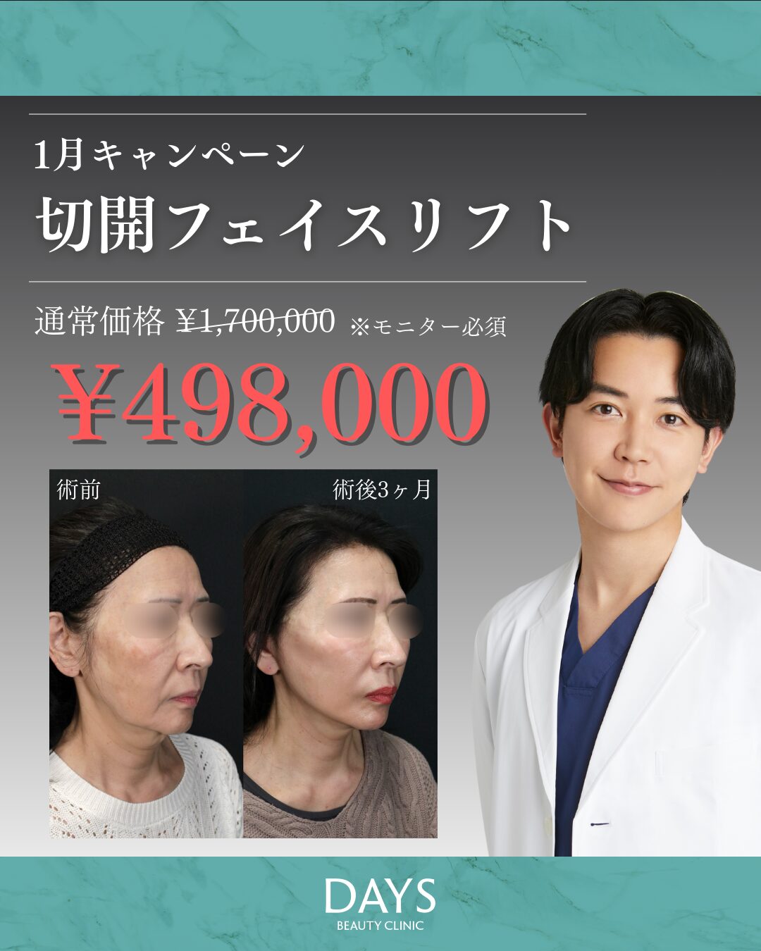 フェイスリフト 2601