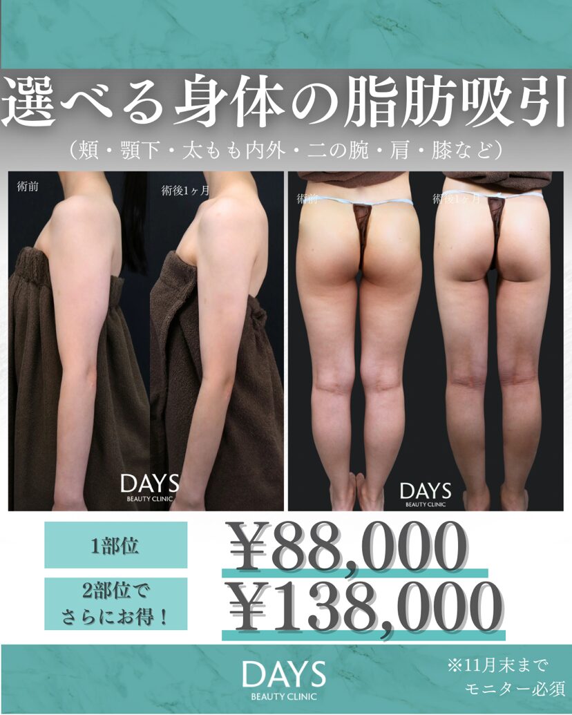 選べる脂肪吸引　2511