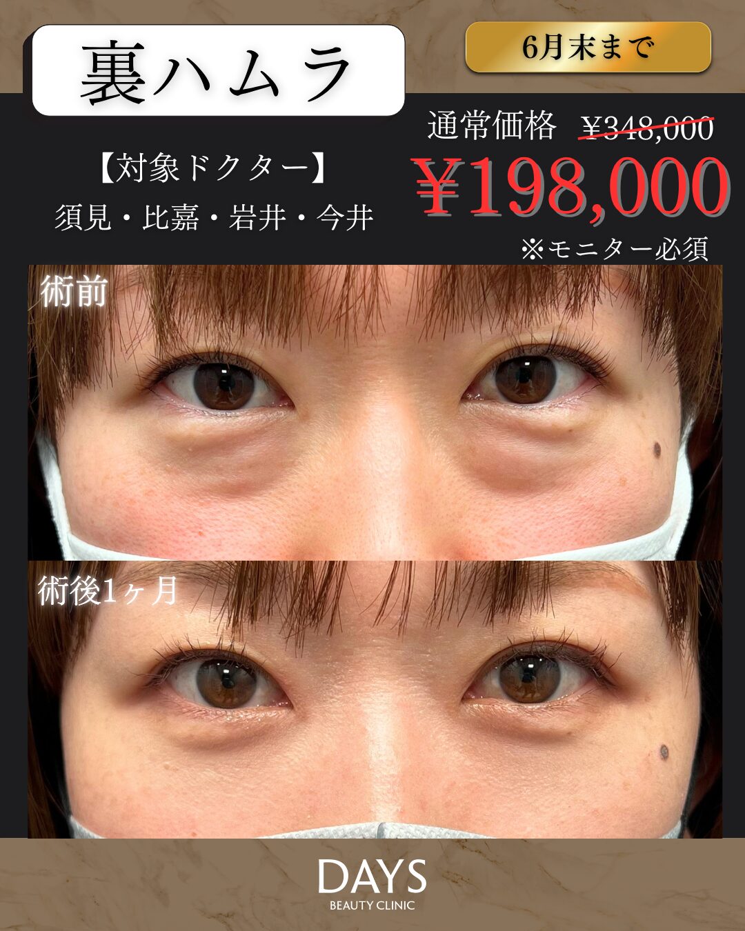 裏ハムラ　比嘉・須見・今井・岩井　2606