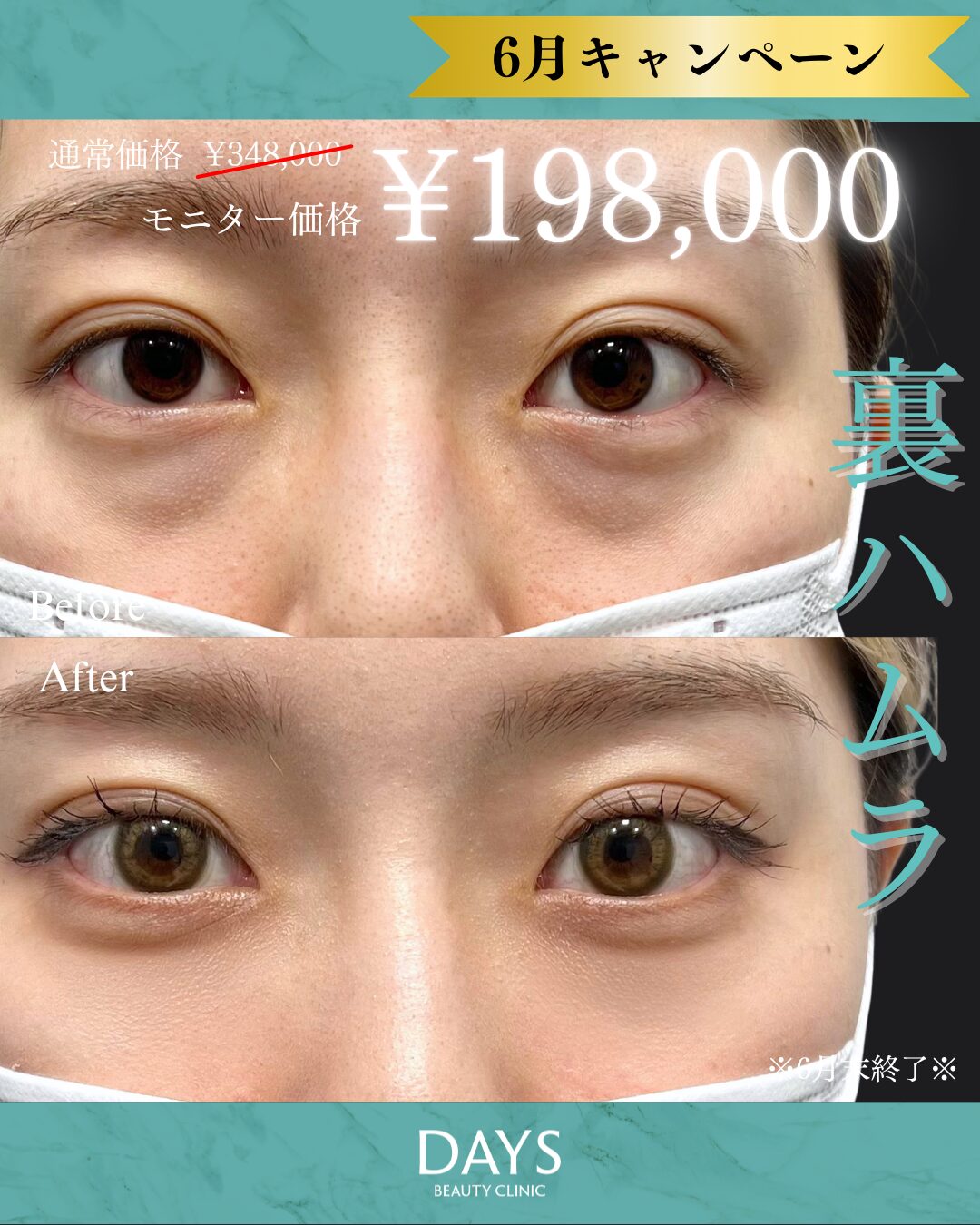 裏ハムラ　比嘉　2606