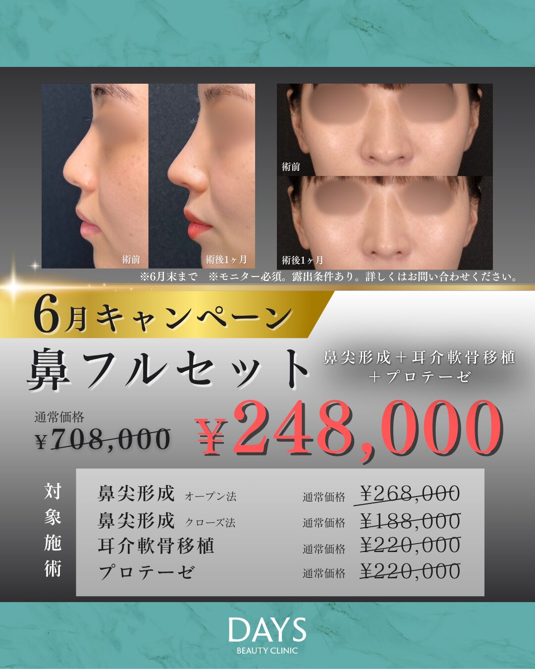 鼻フル 田嶋　2606