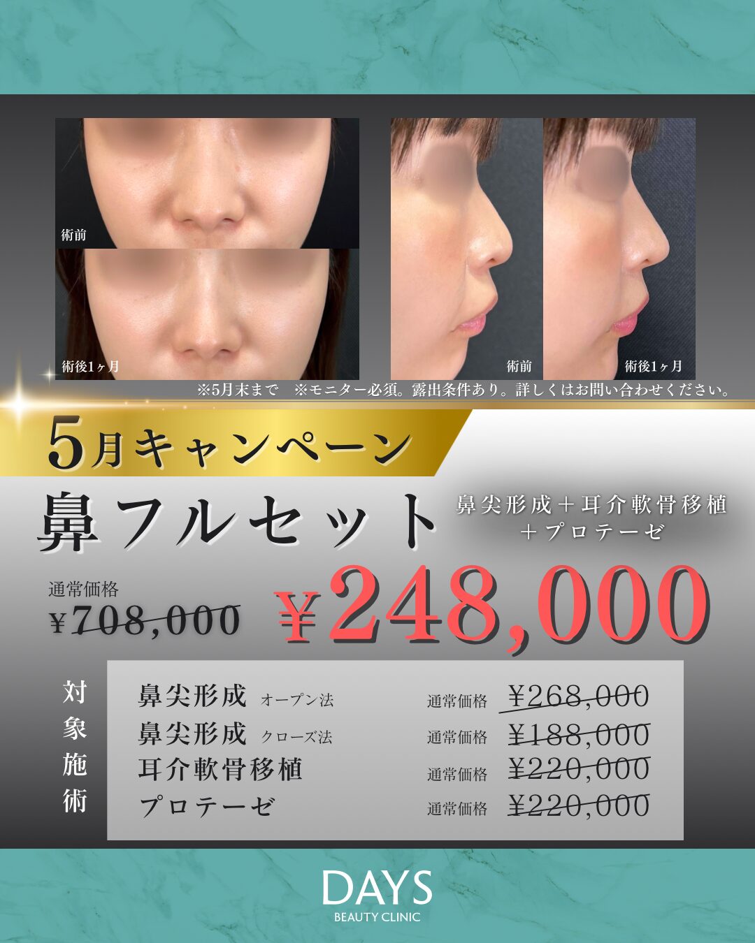 鼻フル 田嶋　2605