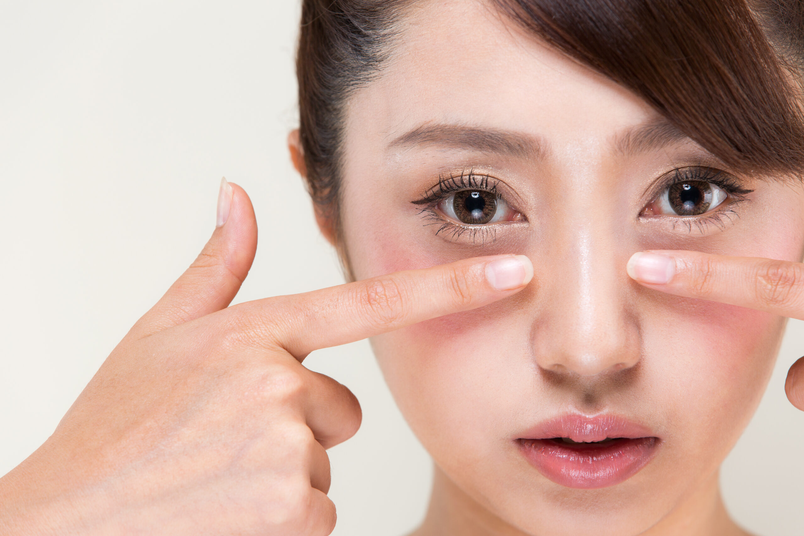 若いのに目の下のくぼみはなぜ？原因と改善方法を専門医が解説