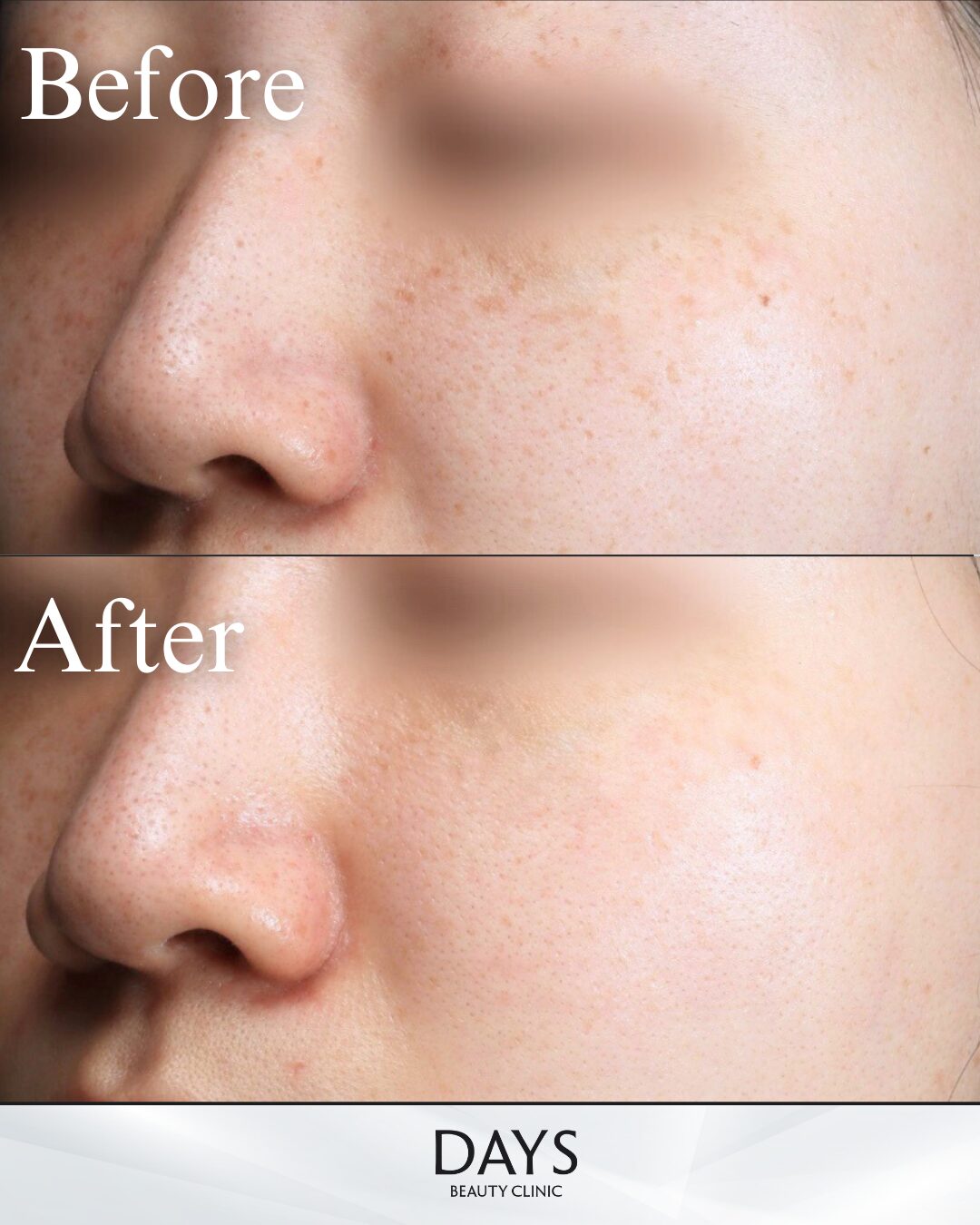 ルメッカピーク-1