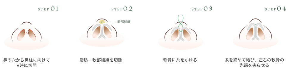 オープン法施術イメージ