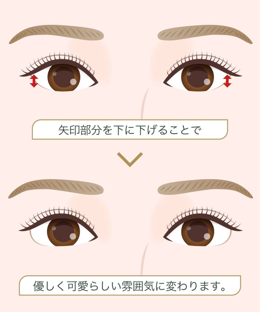 グラマラスライン形成イメージ