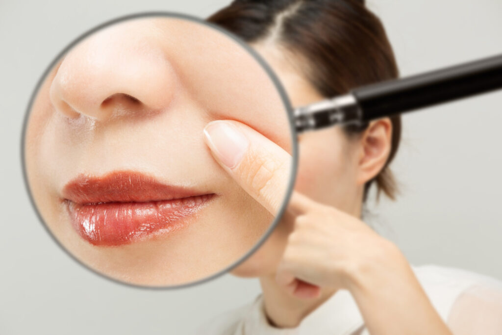 20代でほうれい線が目立つ理由|若年層に多い特徴とは