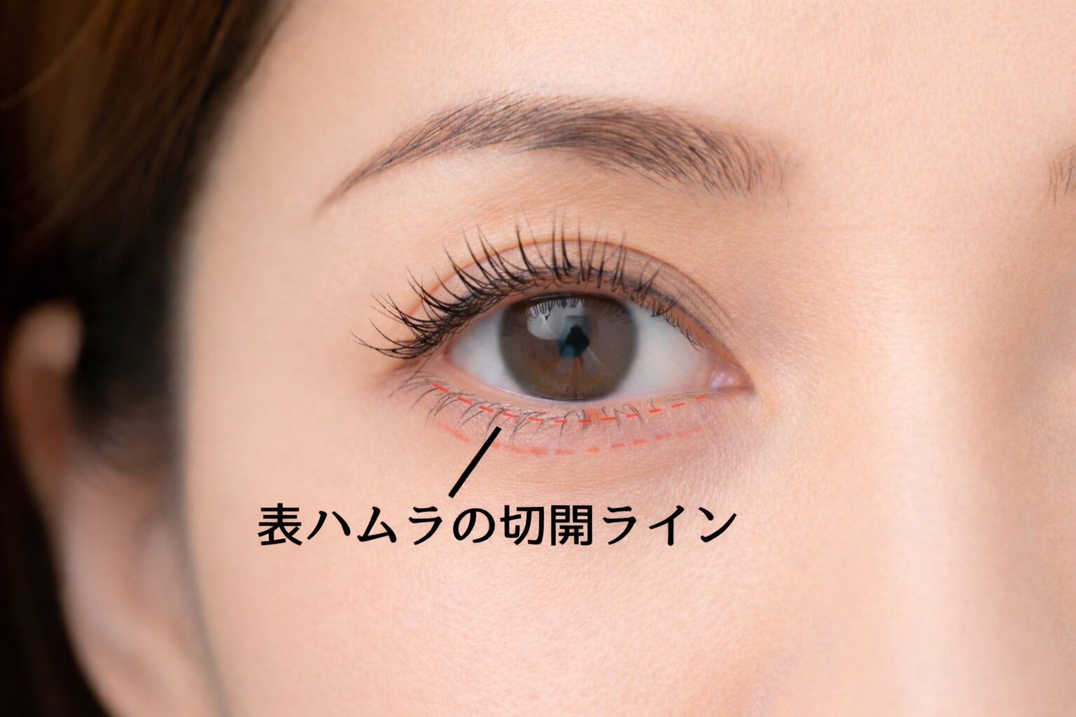 表ハムラとは何？効果・向いている人・裏ハムラとの違いを解説