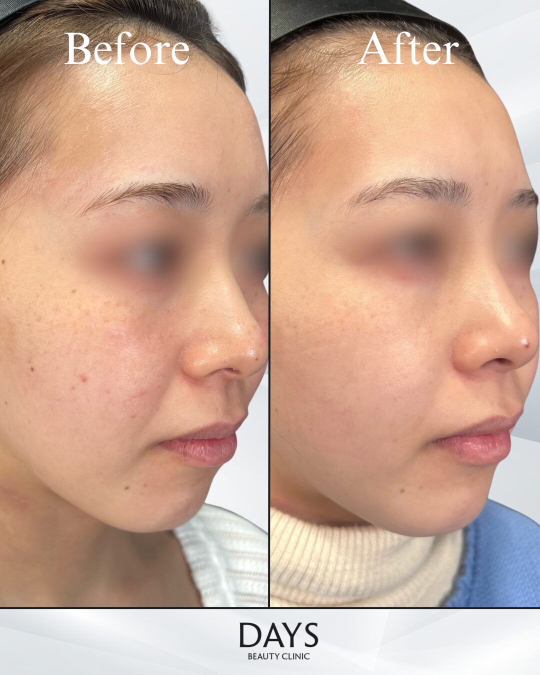 ルメッカピーク-1