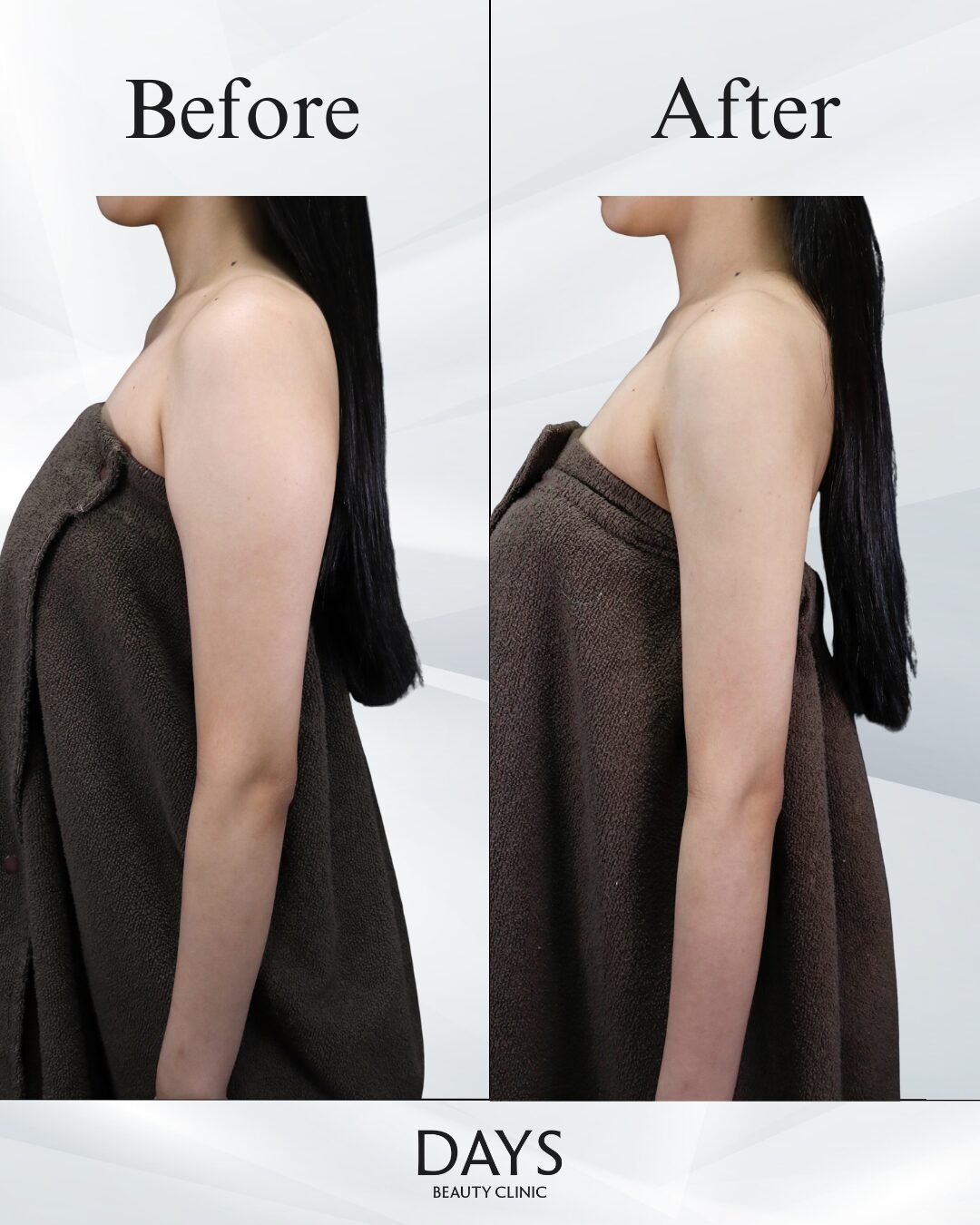 鍋田-森田症例-35