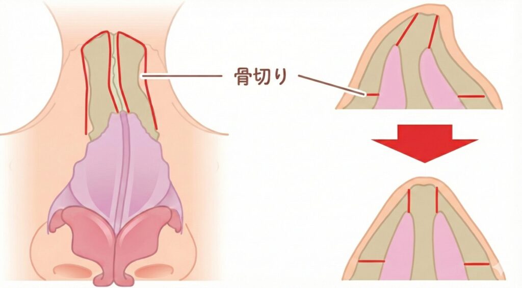 施術イメージ03
