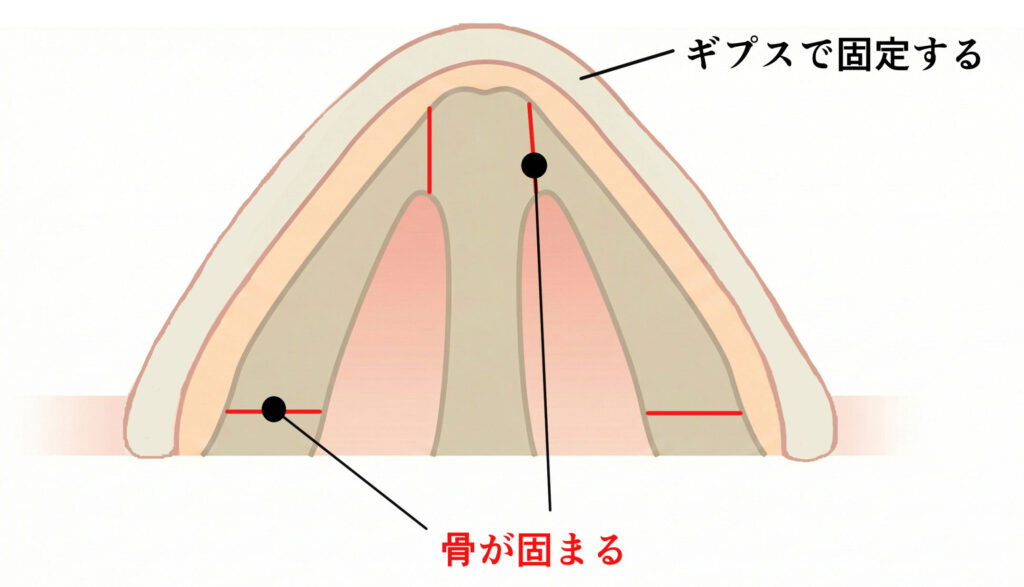 施術イメージ05