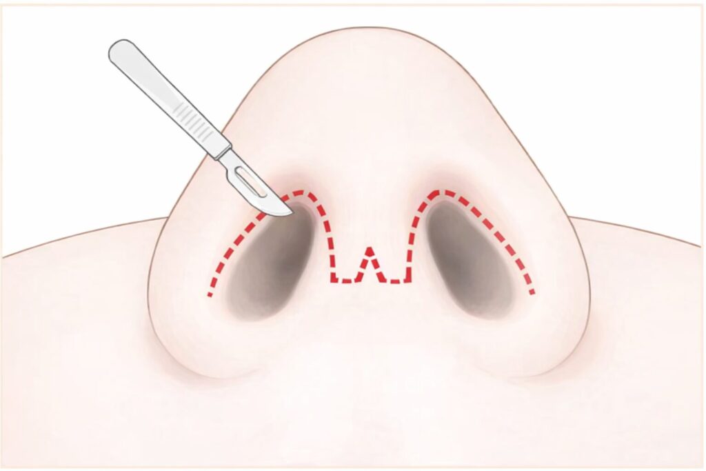 施術イメージ01