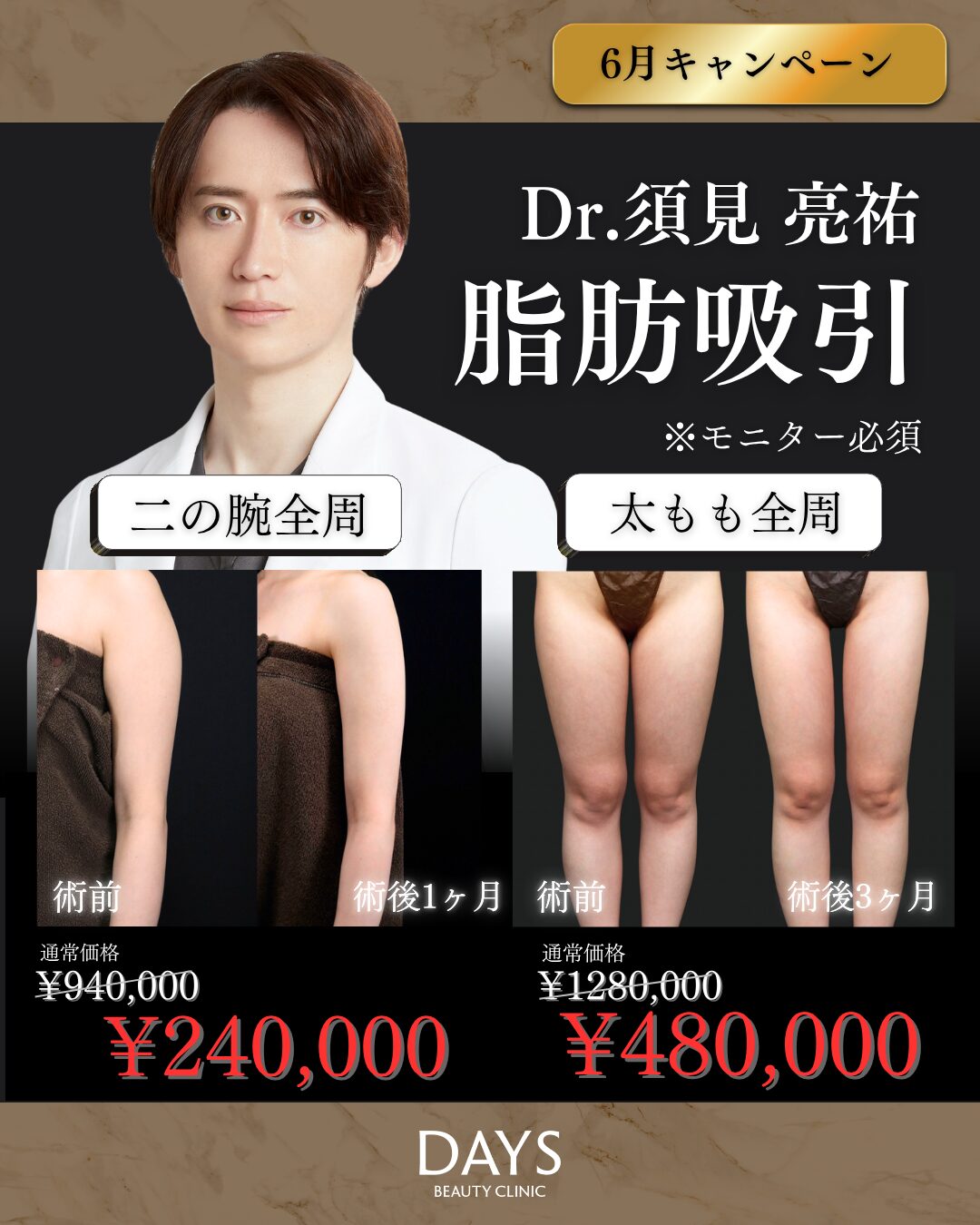 脂肪吸引　須見　2606