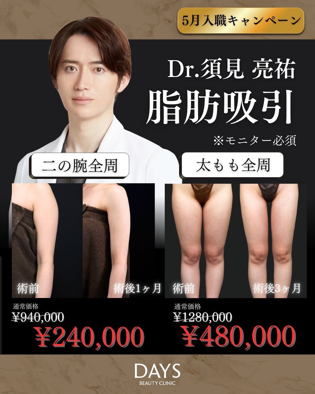 脂肪吸引　須見　2605