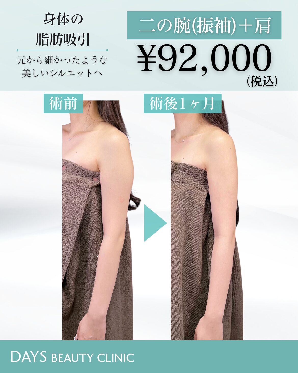 二の腕脂肪吸引 藤塚 2609
